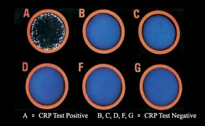 crp test